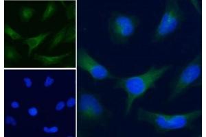 IF/ICC staining of human HeLa cells with Alexa Fluor 488 secondary, and GAPDH antibody at 5ug/ml (blue = DAPI nuclear counterstain). (GAPDH Antikörper)