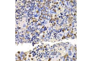 Immunohistochemistry of paraffin-embedded rat spleen using UBE2V2 antibody. (UBE2V2 Antikörper  (AA 1-145))