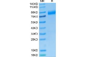 SDS-PAGE (SDS) image for NKG2A & CD94 protein (mFc Tag) (ABIN7275327)