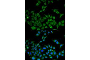 Immunofluorescence analysis of HeLa cells using DIDO1 antibody (ABIN5973852). (DIDO1 Antikörper)