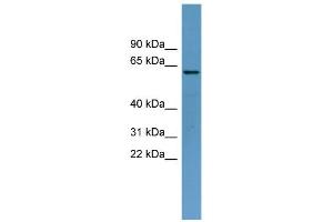 WB Suggested Anti-TOM1 Antibody Titration: 0. (TOM1 Antikörper  (Middle Region))