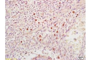 Formalin-fixed and paraffin embedded mouse embryo labeled with Anti-DHFR Polyclonal Antibody, Unconjugated (ABIN1387277) at 1:200 followed by conjugation to the secondary antibody and DAB staining (Dihydrofolate Reductase Antikörper)