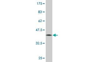 Western Blot detection against Immunogen (35. (ZHX3 Antikörper  (AA 863-955))