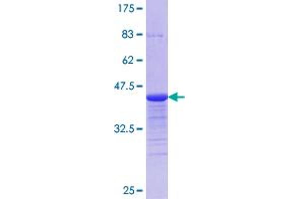 HIPK2 Protein (AA 961-1065) (GST tag)