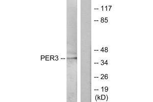 Western blot analysis of extracts from Jurkat cells, treated with insulin (0. (PER3 Antikörper  (N-Term))