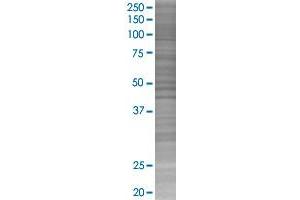 Western Blotting (WB) image for NRP2 293T Cell Transient Overexpression Lysate(Denatured) (ABIN1334268)