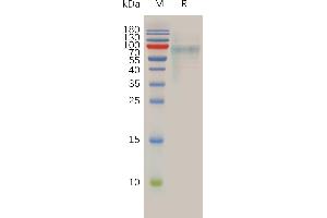 SLC39A6 Protein (AA 29-325) (His tag)