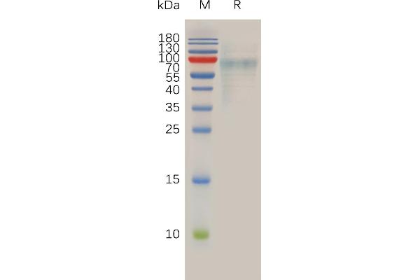 SLC39A6 Protein (AA 29-325) (His tag)