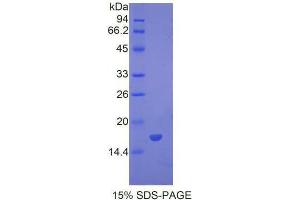 SDS-PAGE analysis of Mouse BMP7 Protein. (BMP7 Protein)