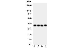 Western blot testing of CD34 antibody and Lane 1:  MCF-7;  2: MM231;  3: SMMC-7721;  4: HepG2 lysate. (CD34 Antikörper  (AA 151-385))
