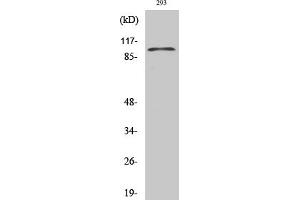 Western Blot analysis of 293 cells using E-cadherin Polyclonal Antibody diluted at 1:1000. (E-cadherin Antikörper  (AA 1-80))