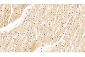 Detection of GATA4 in Human Cardiac Muscle Tissue using Polyclonal Antibody to GATA Binding Protein 4 (GATA4) (GATA4 Antikörper  (AA 201-442))