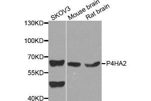 Western Blotting (WB) image for anti-Prolyl 4-Hydroxylase, alpha Polypeptide II (P4HA2) (AA 234-533) antibody (ABIN6220566) (P4HA2 Antikörper  (AA 234-533))