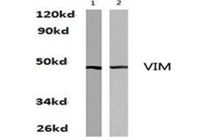 Image no. 1 for anti-Vimentin (VIM) antibody (ABIN271977) (Vimentin Antikörper)