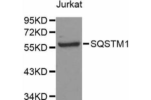 Western blot analysis of extracts of Jurkat cells, using SQSTM1 antibody (ABIN5998954) at 1/1000 dilution. (SQSTM1 Antikörper)