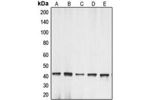 Western blot analysis of Gamma-actin-1 expression in HeLa (A), Raw264. (gamma-Actin-1 (C-Term) Antikörper)