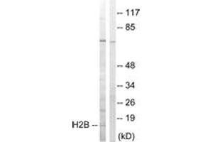 Western blot analysis of extracts from Jurkat cells, treated with UV 15', using Histone H2B (Ab-14) Antibody. (Histone H2B Antikörper  (AA 1-50))