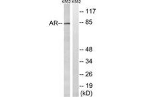 Western Blotting (WB) image for anti-Androgen Receptor (AR) (AA 331-380) antibody (ABIN2889124) (Androgen Receptor Antikörper  (AA 331-380))