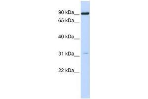 Western Blot showing CHRNA4 antibody used at a concentration of 1-2 ug/ml to detect its target protein. (CHRNA4 Antikörper  (N-Term))