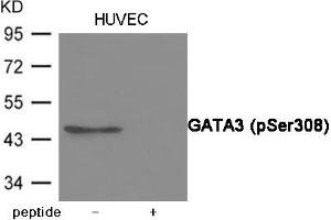 Western blot analysis of extracts from HUVEC cells using GATA3 (Phospho-Ser308) Antibody. (GATA3 Antikörper  (pSer308))