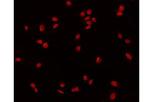 ABIN6268818 staining 293 by IF/ICC. (GATA6 Antikörper  (Internal Region))