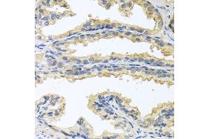 Immunohistochemistry of paraffin-embedded human prostate using OSM antibody. (Oncostatin M Antikörper)