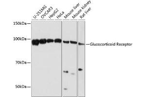 Western blot analysis of extracts of various cell lines, using Glucocorticoid Receptor antibody (ABIN7269016) at 1:1000 dilution. (Glucocorticoid Receptor Antikörper)