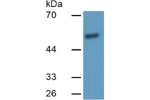 Western Blotting (WB) image for Matrix Metallopeptidase 11 (Stromelysin 3) (MMP11) ELISA Kit (ABIN6574149)