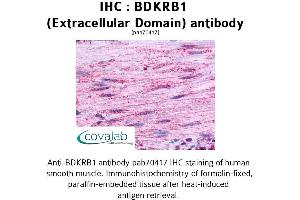 Image no. 1 for anti-Bradykinin Receptor B1 (BDKRB1) (2nd Extracellular Domain) antibody (ABIN1732269) (BDKRB1 Antikörper  (2nd Extracellular Domain))