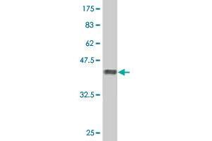 Western Blot detection against Immunogen (37. (LIMK2 Antikörper  (AA 152-252))