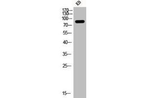 Western Blot analysis of KB cells using Phospho-PI 3-kinase p85α (Y607) Polyclonal Antibody (PIK3R1 Antikörper  (pTyr607))