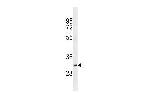 Western blot analysis in K562 cell line lysates (35ug/lane). (SYCE1L Antikörper  (C-Term))