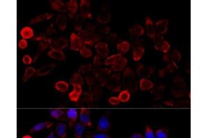 Immunofluorescence analysis of HeLa cells using KAT7 Polyclonal Antibody at dilution of 1:100 (40x lens). (MYST2 Antikörper)