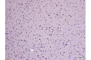 Immunohistochemistry (Paraffin-embedded Sections) (IHC (p)) image for anti-Catenin, beta (CATNB) (pSer33), (pSer37) antibody (ABIN683893)