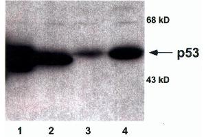 Each lane contains 50µg of total cellular protein separated by 10% SDS-PAGE. (p53 Antikörper)