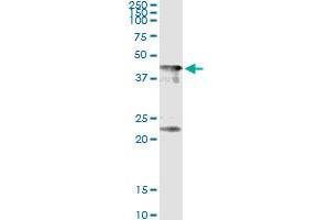 Immunoprecipitation of CENPJ transfected lysate using anti-CENPJ monoclonal antibody and Protein A Magnetic Bead , and immunoblotted with CENPJ MaxPab rabbit polyclonal antibody. (CENPJ Antikörper  (AA 979-1088))