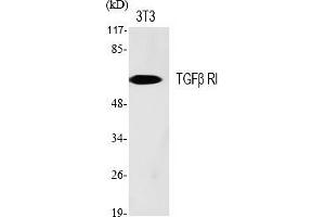 Western Blot analysis of various cells using TGFβ RI Polyclonal Antibody diluted at 1:500. (TGFBR1 Antikörper)