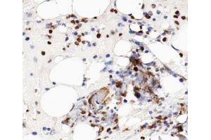 ABIN6266587 at 1/100 staining human bone tissue sections by IHC-P. (MCM5 Antikörper  (N-Term))