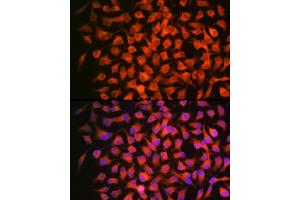 Immunofluorescence analysis of HeLa using RARβ Rabbit mAb (ABIN7269947) at dilution of 1:100 (40x lens). (Retinoic Acid Receptor beta Antikörper)