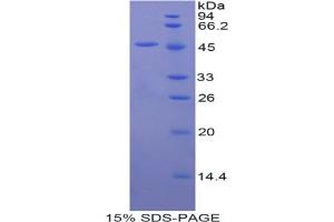 SDS-PAGE analysis of Mouse FGF10 Protein. (FGF10 Protein)