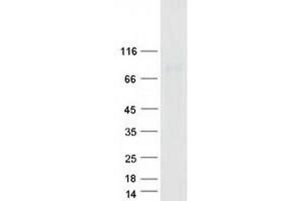 DTX2 Protein (Transcript Variant 1) (Myc-DYKDDDDK Tag)