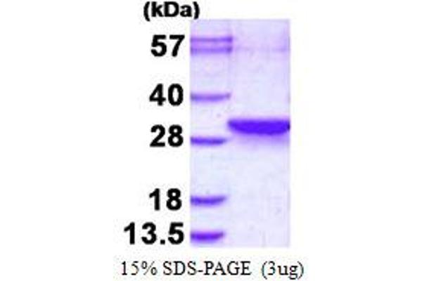 LDOC1L Protein (His tag)