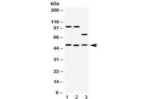 Western blot testing of 1) rat brain, 2) mouse brain and 3) human HeLa lysate with AZIN2 antibody at 0. (ADC Antikörper)