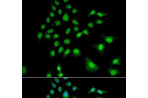 Immunofluorescence analysis of U2OS cells using UBE3C Polyclonal Antibody (UBE3C Antikörper)