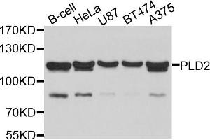 Western blot analysis of extracts of various cell lines, using PLD2 antibody (ABIN6003877) at 1/1000 dilution. (Phospholipase D2 Antikörper)