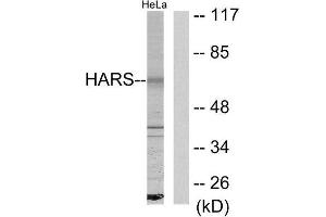 Western Blotting (WB) image for anti-Histidyl-tRNA Synthetase (HARS1) (C-Term) antibody (ABIN1849156) (HARS1/Jo-1 Antikörper  (C-Term))