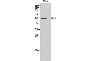 Western Blotting (WB) image for anti-Checkpoint Kinase 1 (CHEK1) (Ser317) antibody (ABIN5961570) (CHEK1 Antikörper  (Ser317))