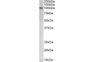 ABIN4902684 (1µg/ml) staining HeLa nuclear lysate (35µg protein in RIPA buffer). (KAP1 Antikörper)