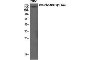 Western Blotting (WB) image for anti-Nitric Oxide Synthase 3 (Endothelial Cell) (NOS3) (pSer1177) antibody (ABIN5961402) (ENOS Antikörper  (pSer1177))