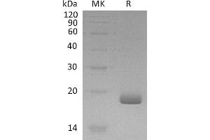 Greater than 95 % as determined by reducing SDS-PAGE. (IL28B Protein)